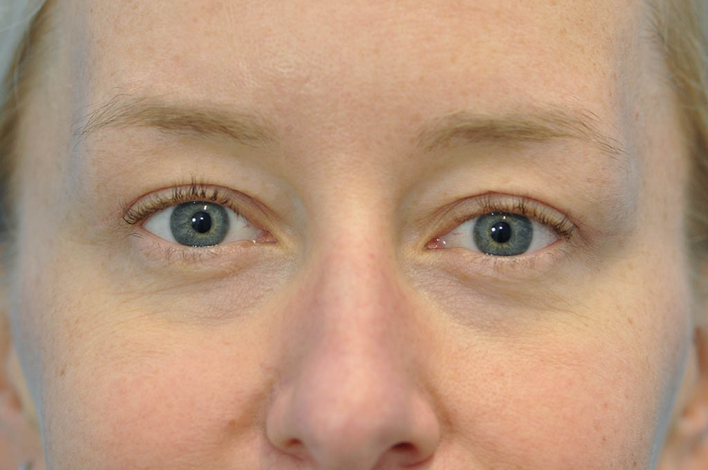 after image